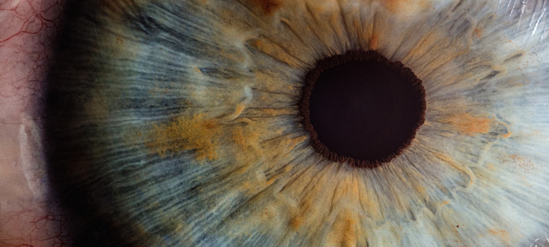 Human Eye