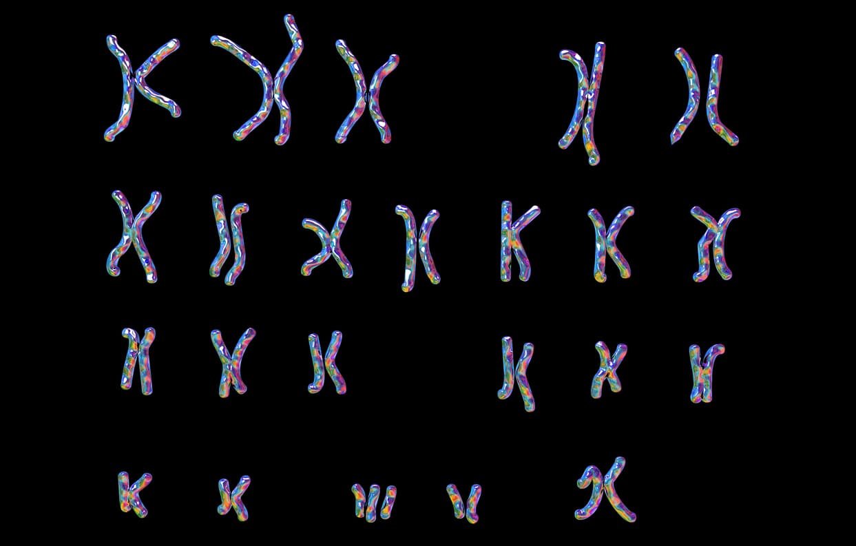 trisomy 21 chromosome diagram