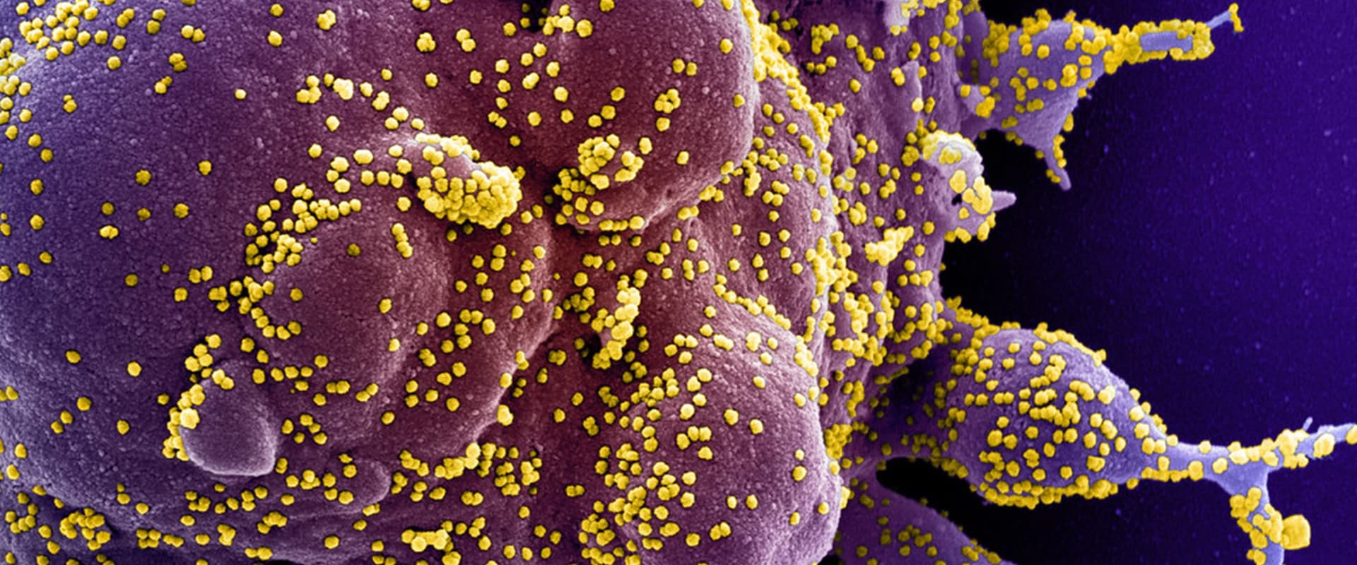 image of the Sars Cov 2 virus from NIAID