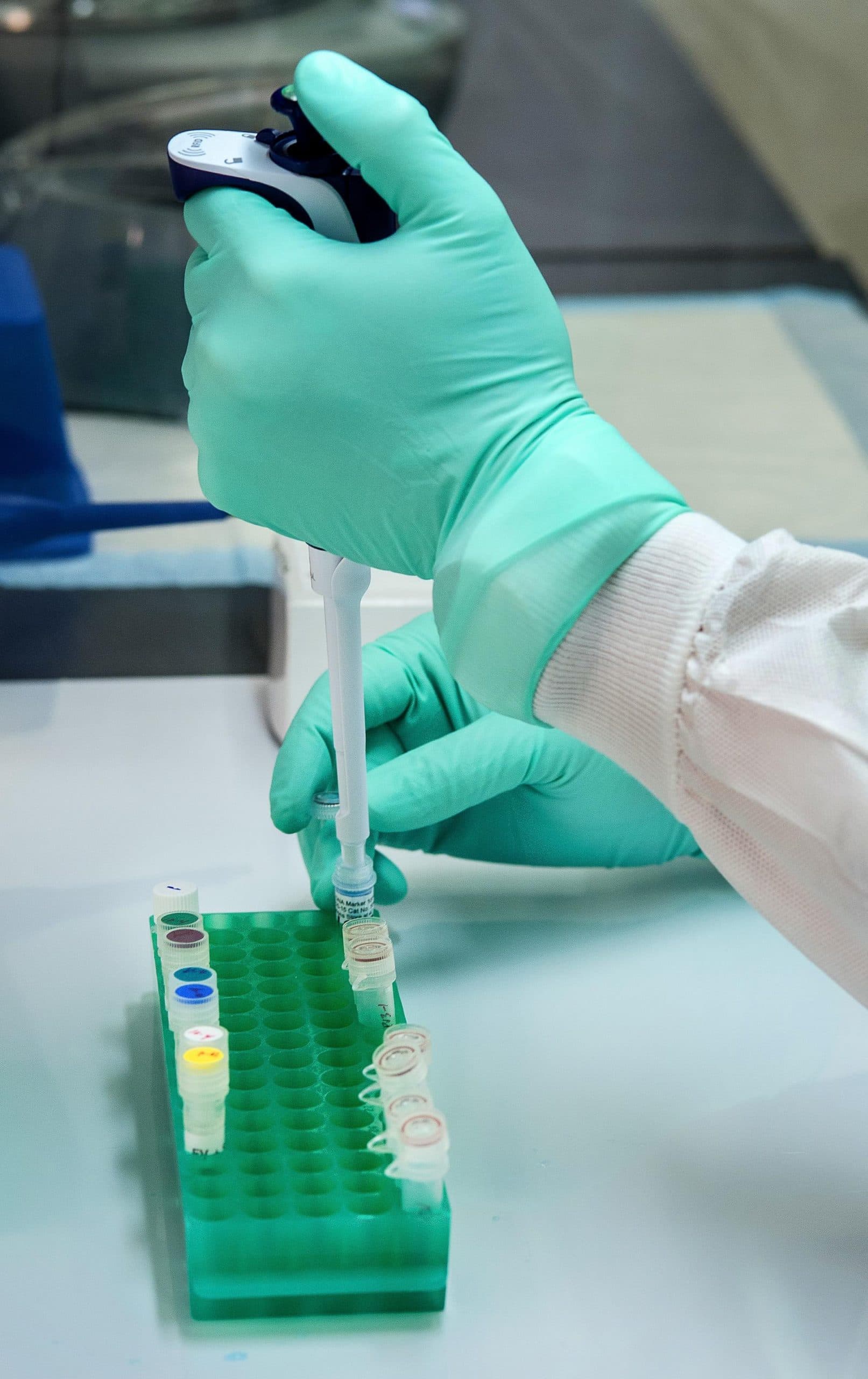 hands pipetting in a lab