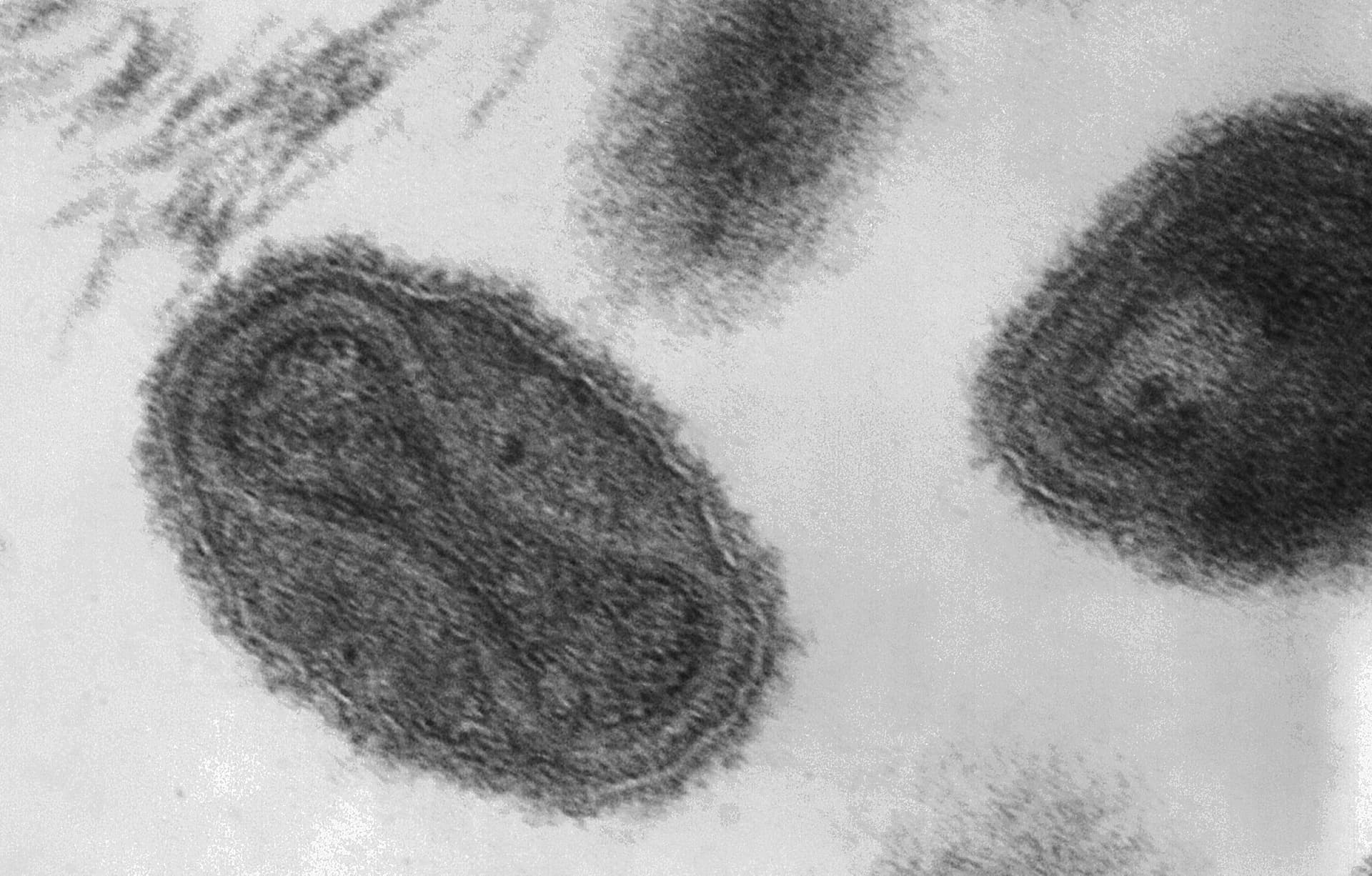 smallpox virus under microscope