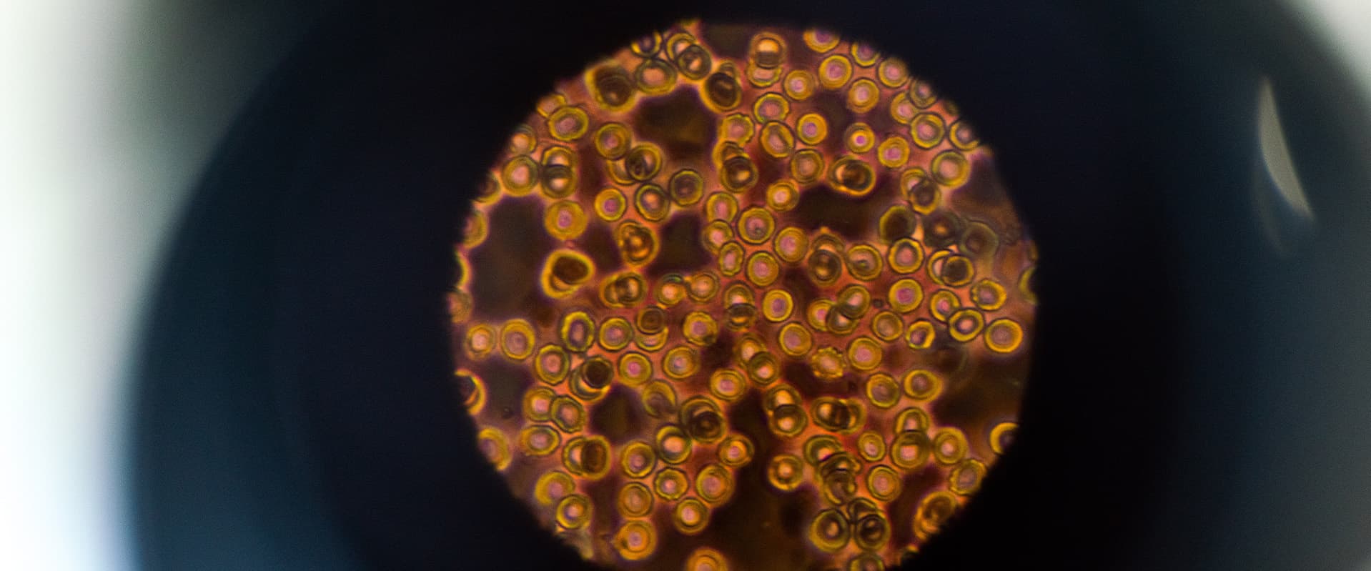 cells seen through a microscope
