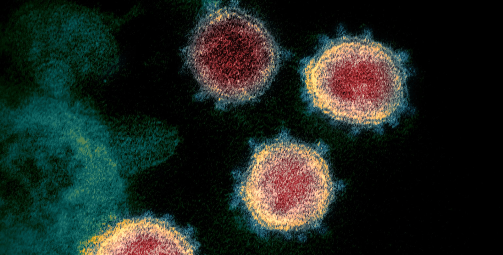 Electron microscope image of SARS CoV-2, the virus that causes COVID-19. Virus particles emerge from the surface of cells on a black background.