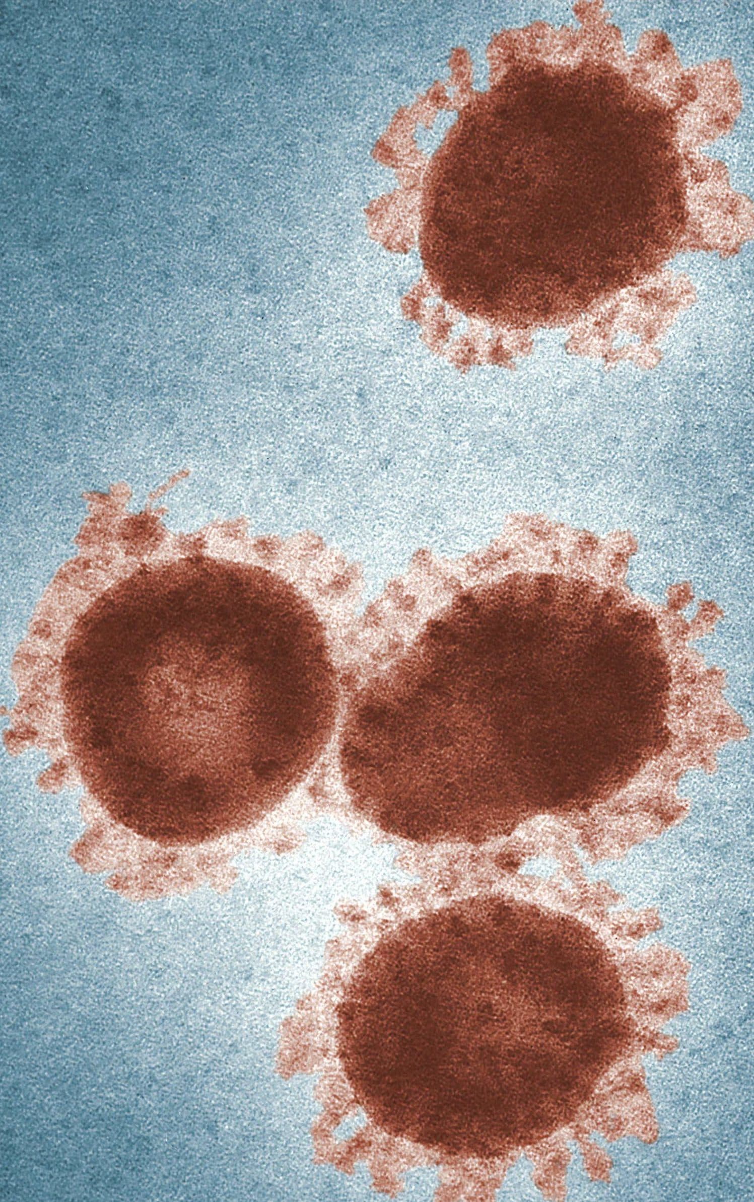 microscope image of a coronavirus