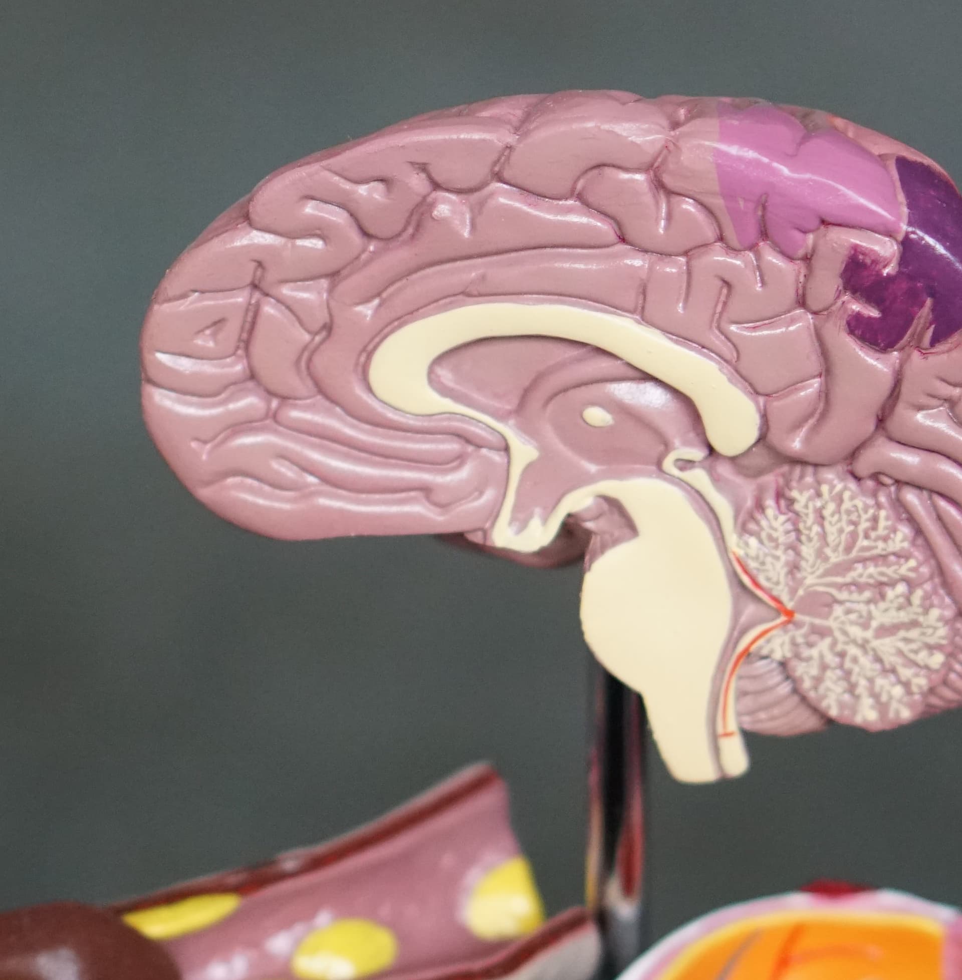 medical model of a brain