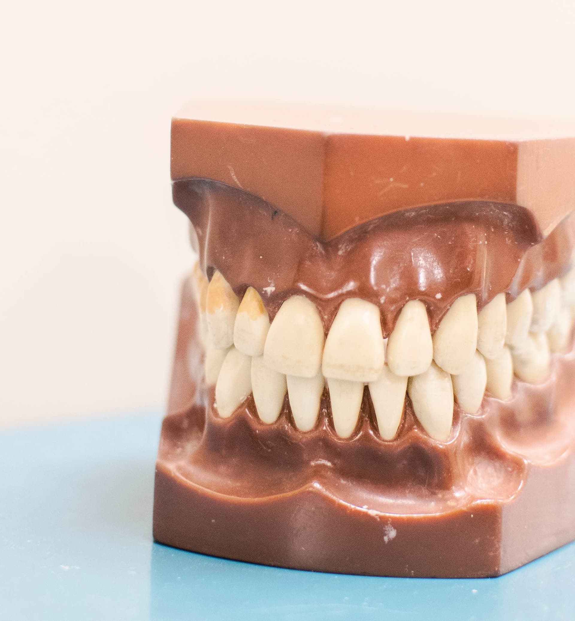 model of teeth