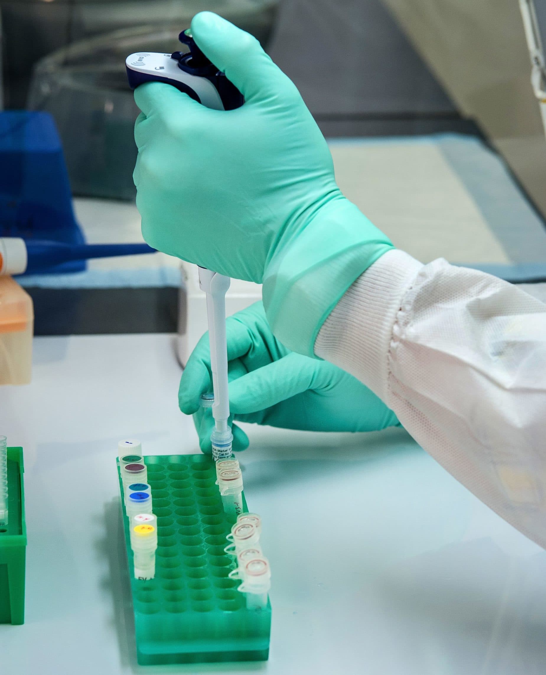 Scientist conducting experiment with pipette