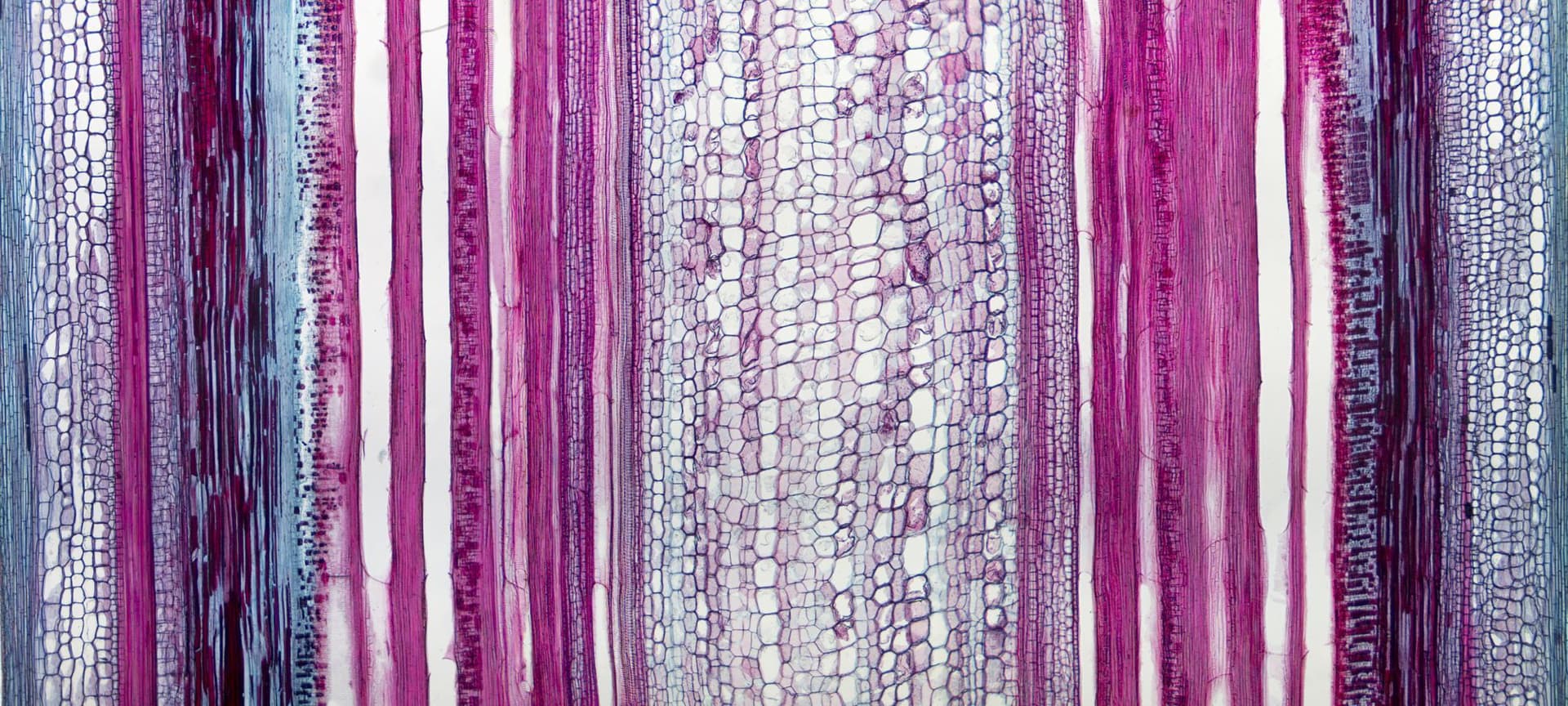 colorful image of plant tissue under the microscope, showing water transportation system